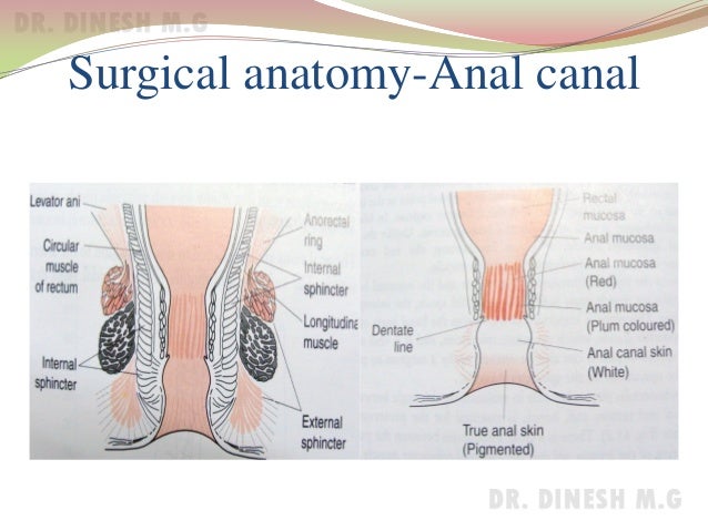 Ectopic anal canal pic 559